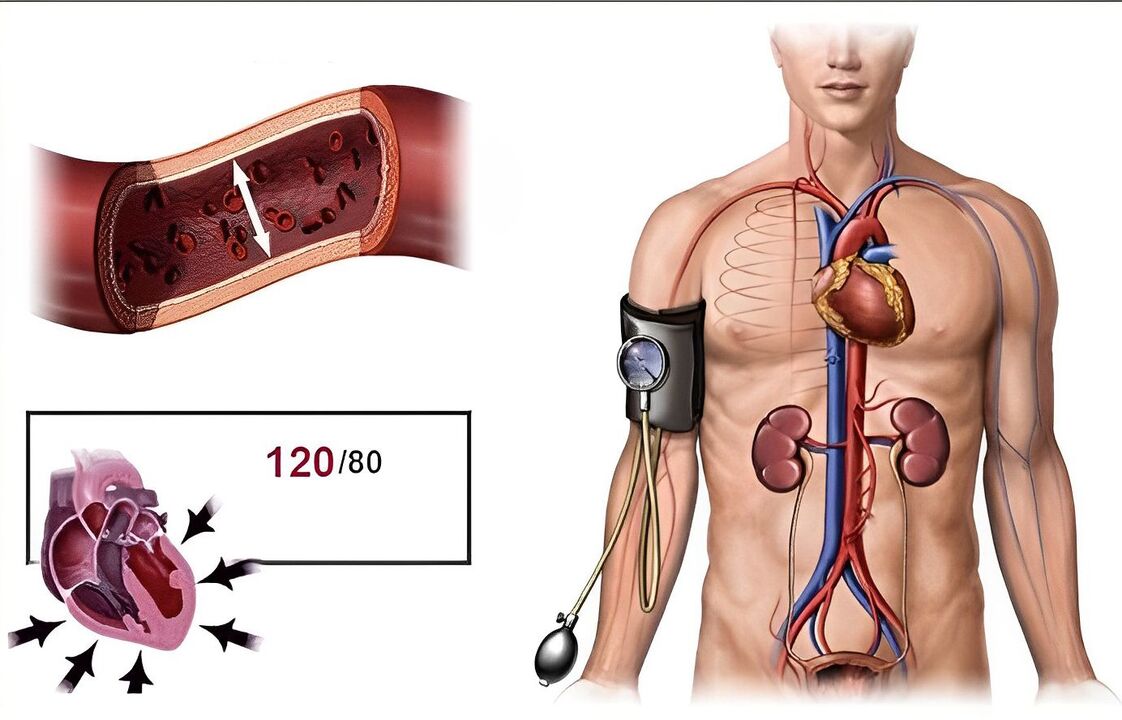 hypertension diastolique